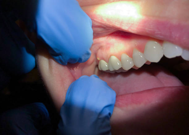 Best Chipped Tooth Repair Near Me  in Mullins, SC