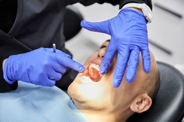 Best Teeth Whitening  in Mullins, SC
